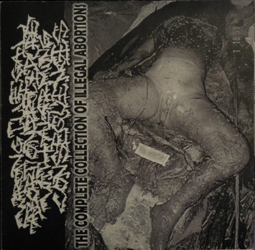 Wrong Illegal Abortion Procedure With Alarming Consequences : The Complete Collection of Illegal Abortions